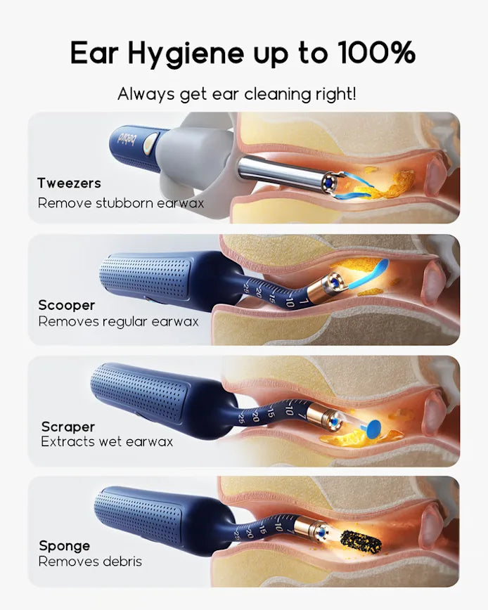 The Ultimate Ear Wax Removal Tool with Camera by Bebird